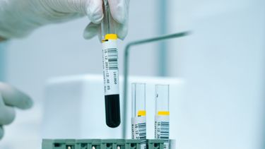 Dit kost een biologische leeftijdsmeting, die je échte leeftijd onthult